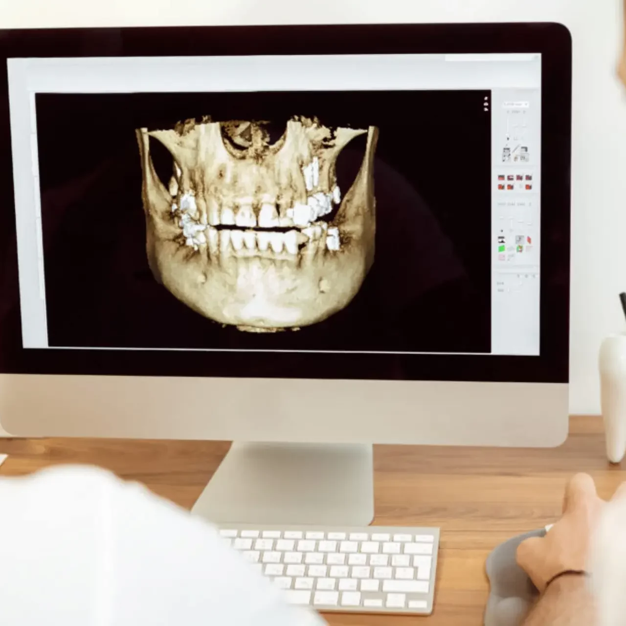 Dental x-ray